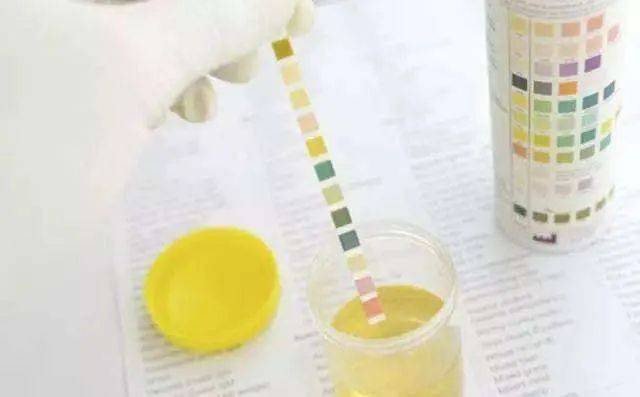 哉阿斯奥特曼2：超人大战·光与影